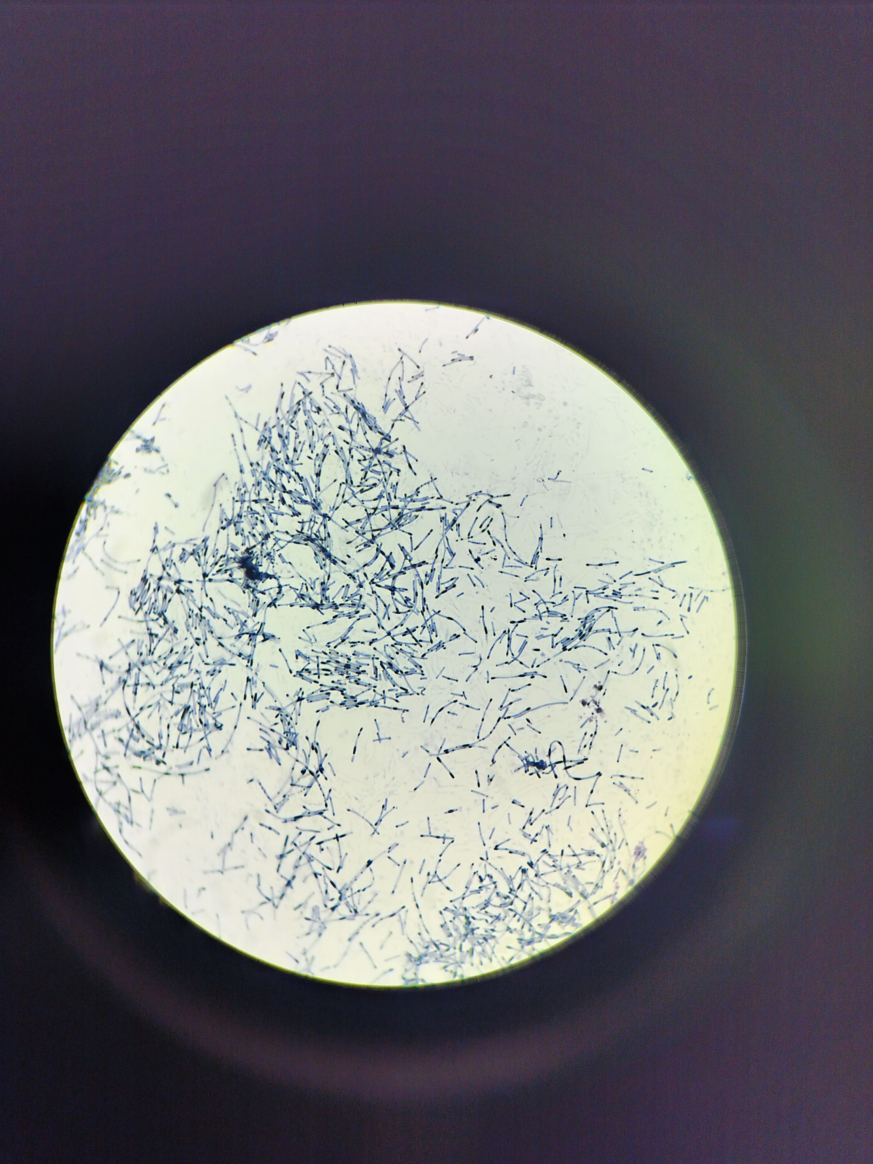 20. Corynobacterium Spp. From Bovine Mastitis